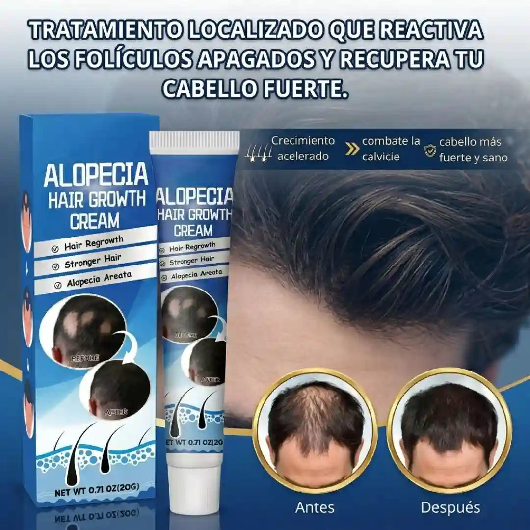 ALOPECIA-RESTAURA TU CABELLO